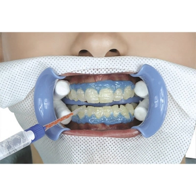 Гель отбеливающий Dual-Barrel Syringe of Beyond II Whitening Gel (4 г)